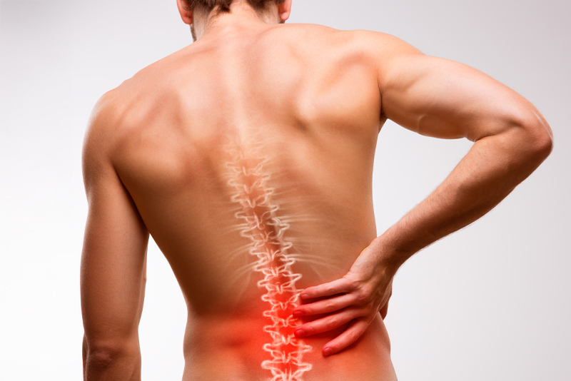 back pain condition image
